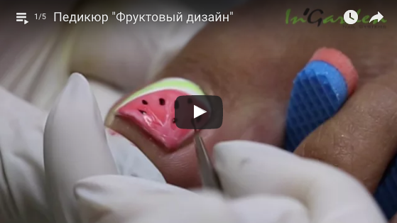Дизайн ногтей: Педикюр "Фруктовый дизайн"